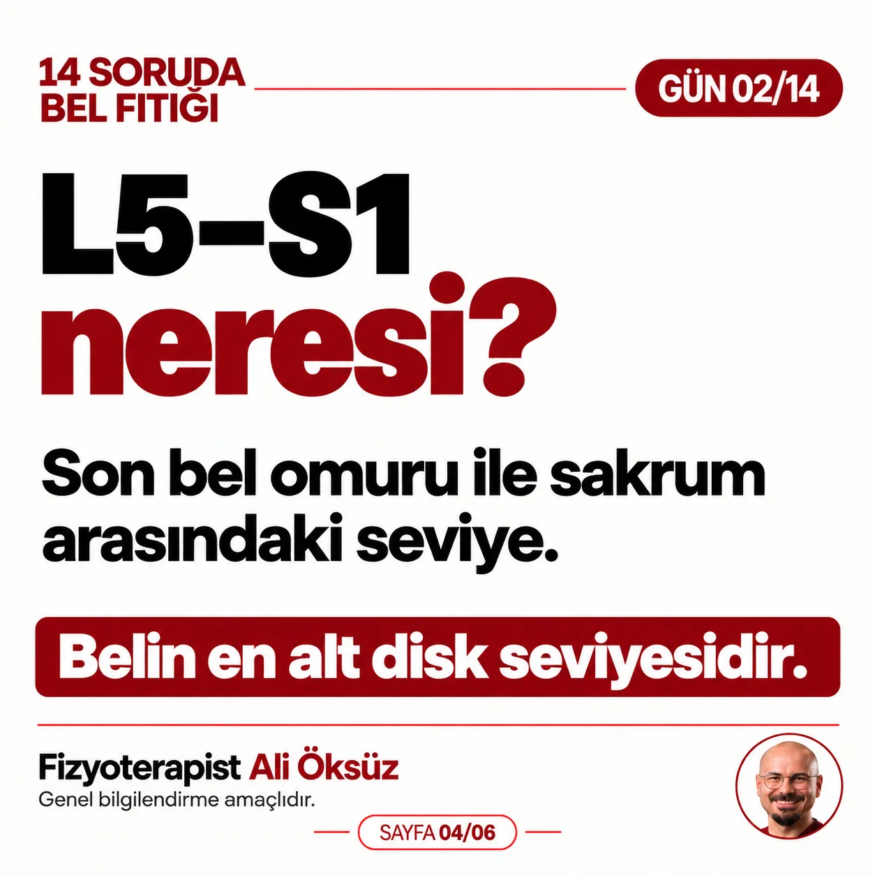 L5-S1 neresi? Son bel omuru ile sakrum arasındaki seviye, belin en alt disk seviyesi