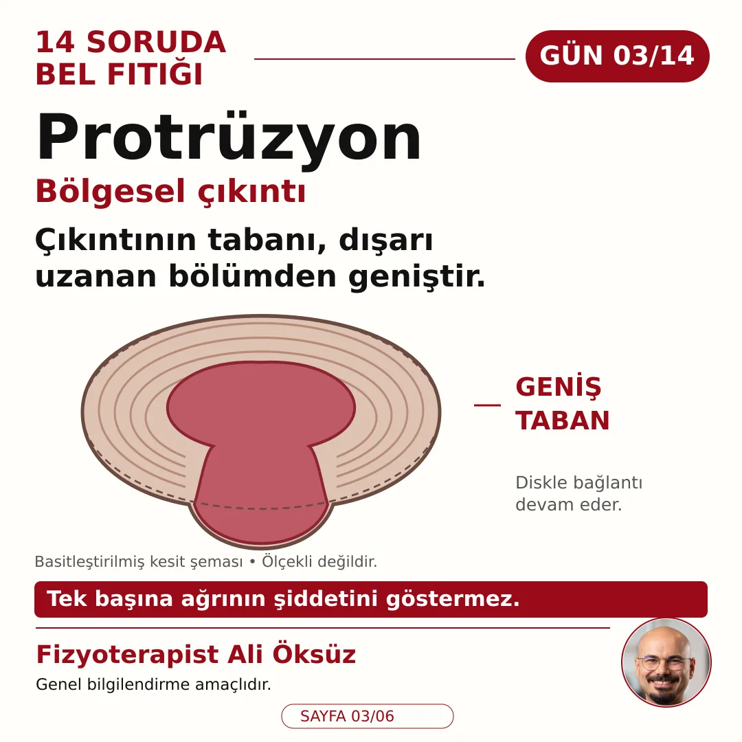 Protrüzyon bölgesel çıkıntı: çıkıntının tabanı dışarı uzanan bölümden geniştir