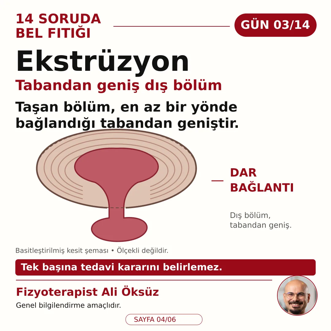 Ekstrüzyon: taşan bölüm en az bir yönde bağlandığı tabandan geniştir, dar bağlantı