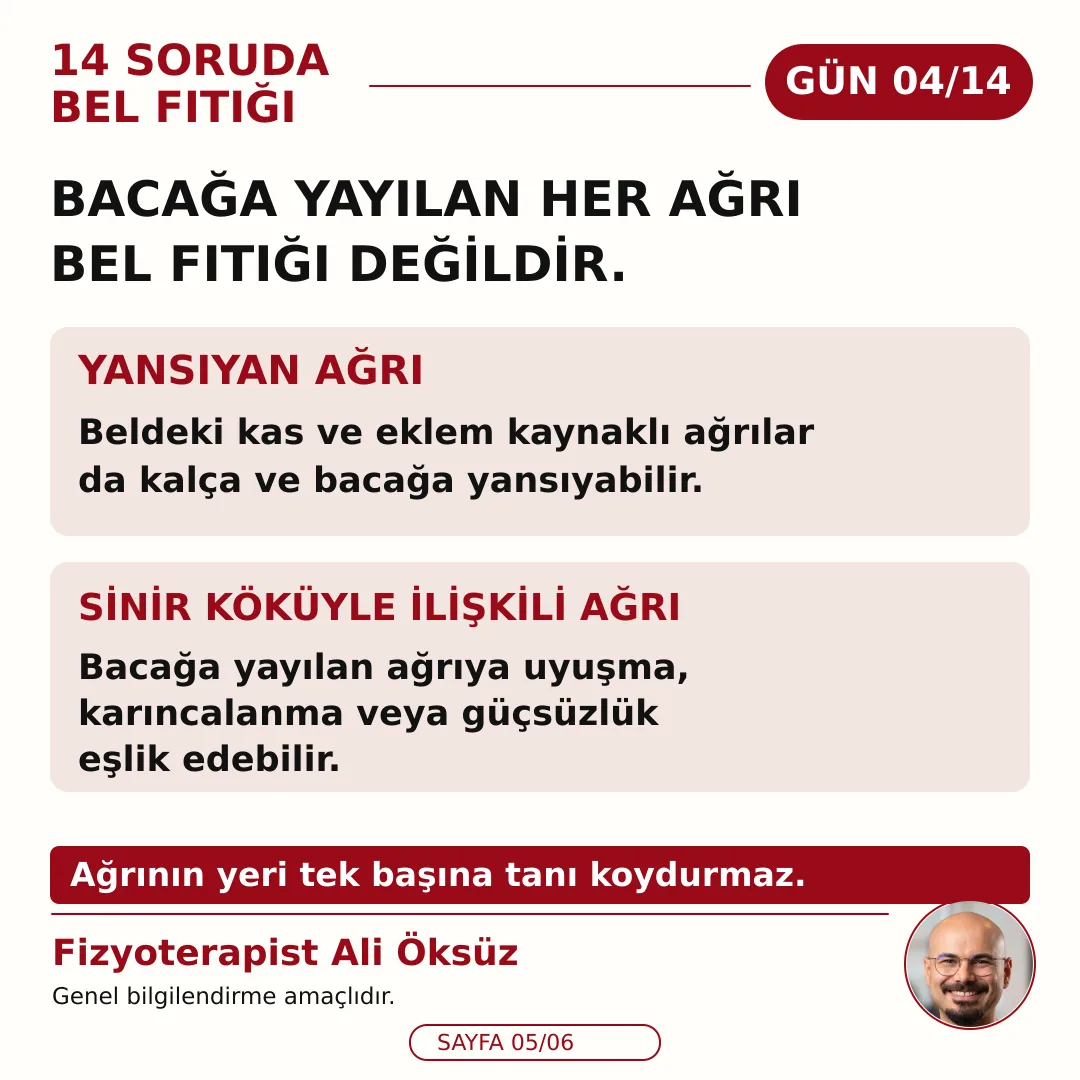 Bacağa yayılan her ağrı bel fıtığı değildir: yansıyan ağrı ve sinir köküyle ilişkili ağrı