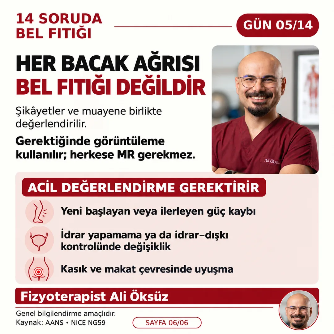 Her bacak ağrısı bel fıtığı değildir; yeni güç kaybı, idrar-dışkı kontrolünde değişiklik ve kasık çevresinde uyuşma acil değerlendirme gerektirir - Antalya Fizyoterapist Ali Öksüz
